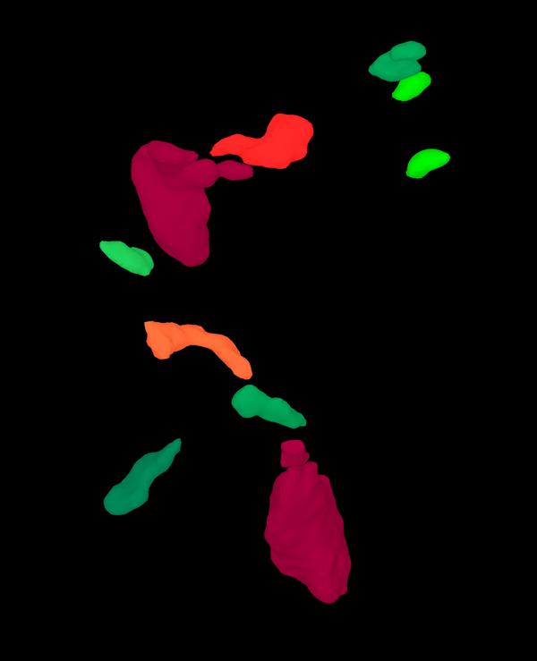 Analisi delle inclusioni nei pezzi