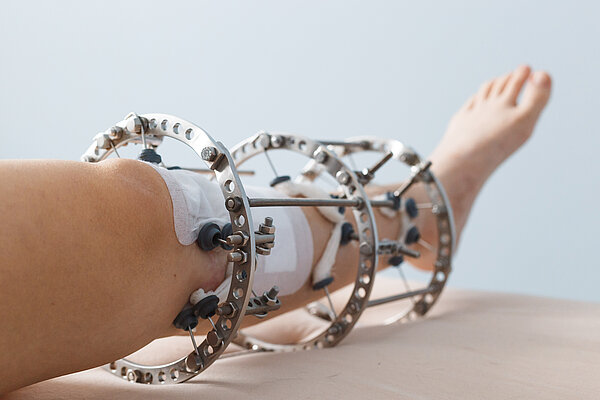 Misurazioni CT automatiche con WinWerth®